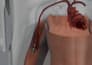 create 3d cardiovascular medical device animation and medical explainer video